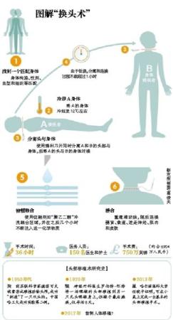 人体换头术最新消息,平衡计划息法策略_高清晰度版94.539